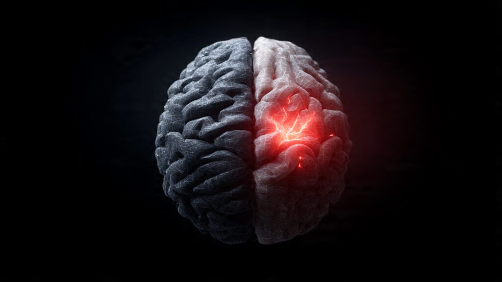 Brain hijacking during revenge trading showing amygdala vs prefrontal cortex